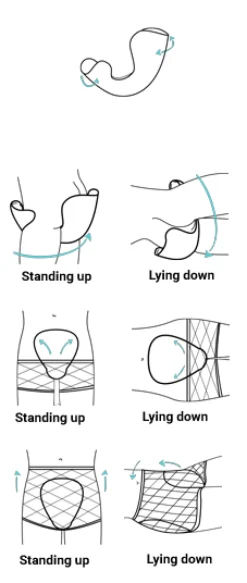 Inkontinens ble til voksne