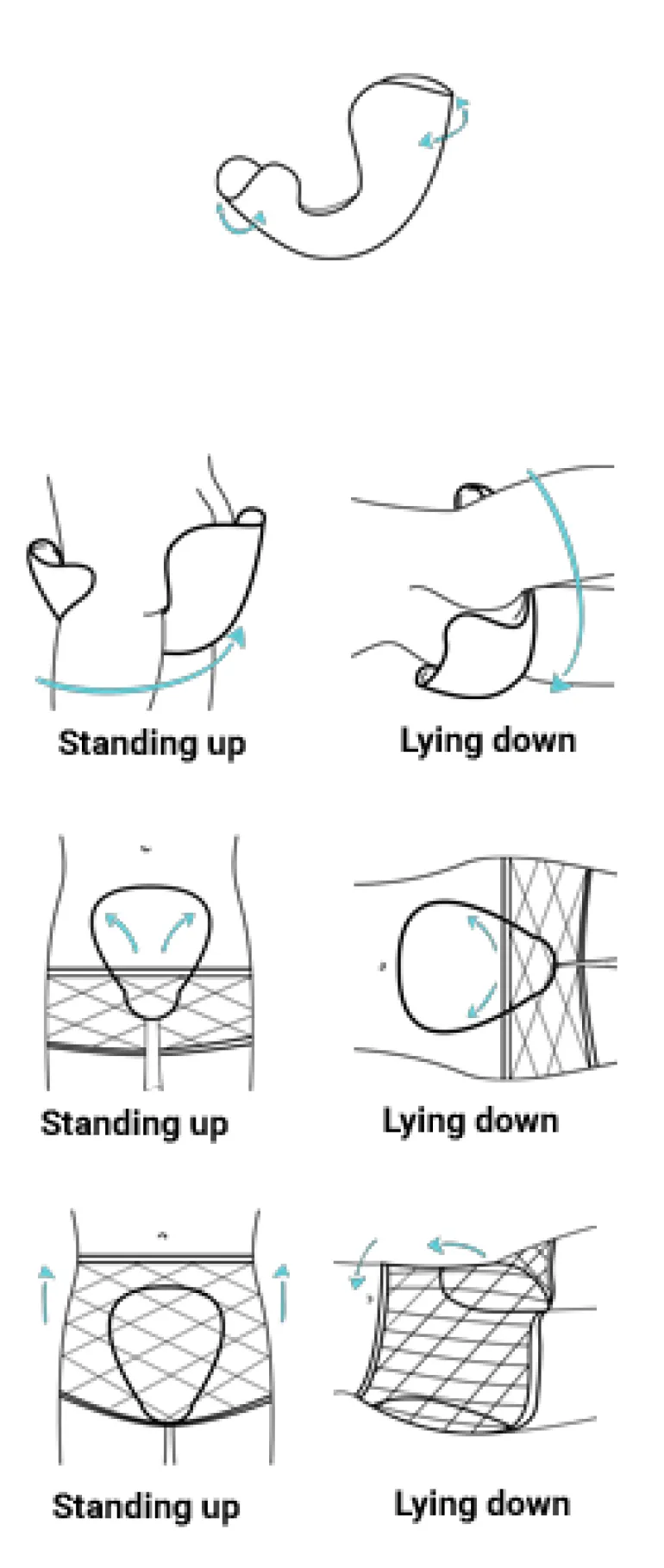 Inkontinens ble til voksne